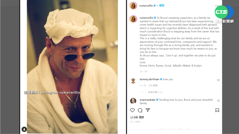 布魯斯威利患失語症 家屬發聲"宣布息影"