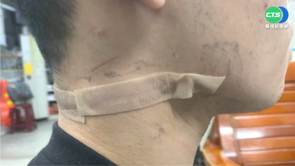高職生遭醋男猛刺頸縫百針 檢:不算殺人