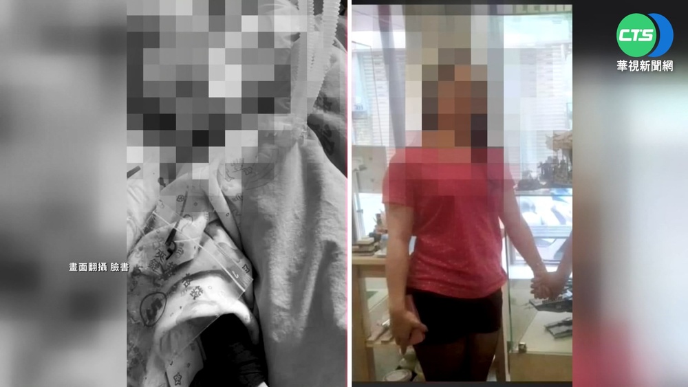 噎奶? 1歲童全身傷顱內出血昏迷...父母控虐