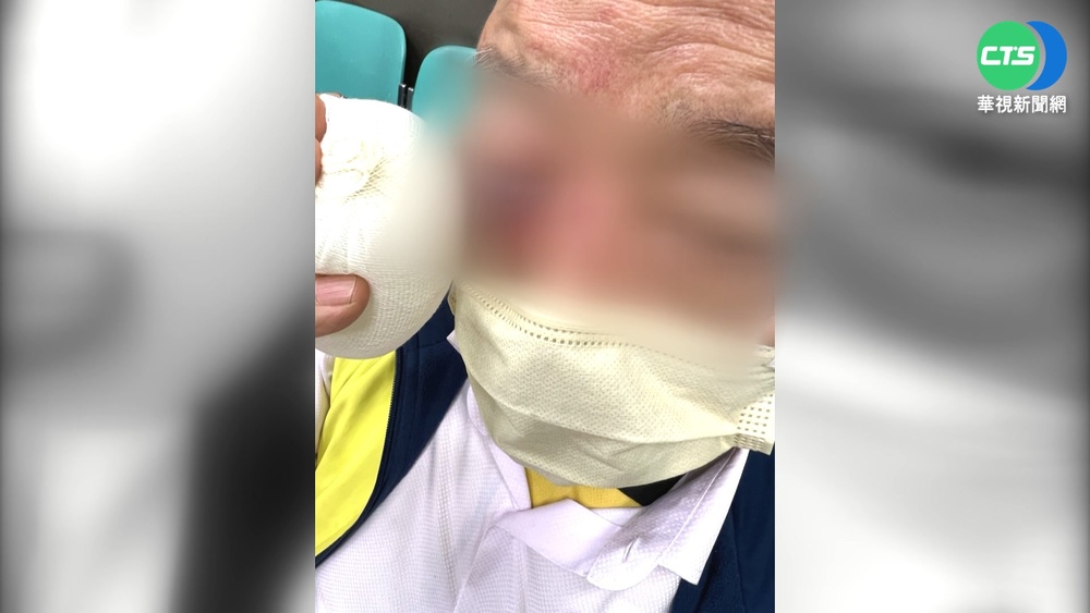 7旬翁遇行車糾紛遭毆 雙方互控傷害