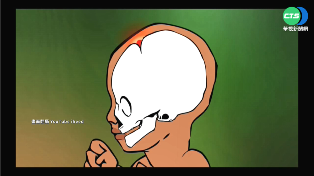 染疫釀腦炎奪童命 醫:沒空窗期應變