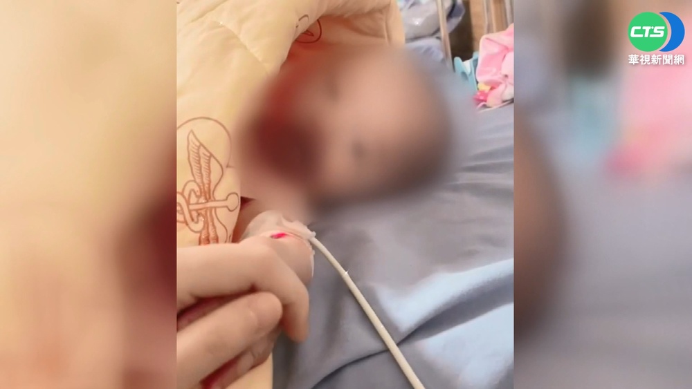 澎湖最小確診者 3個月女嬰高燒40度