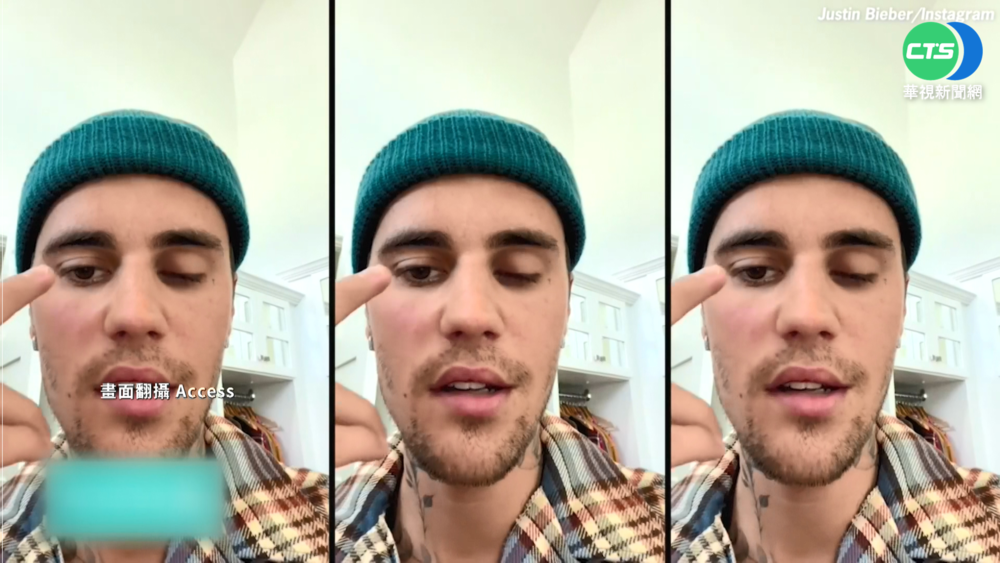 小賈斯汀染罕病半邊臉癱 巡迴演唱迫取消