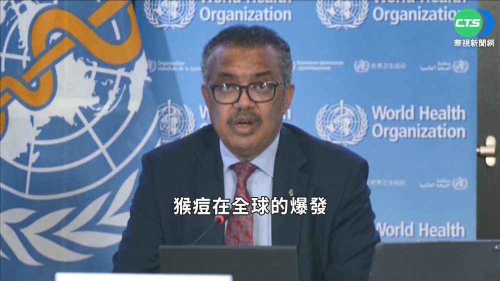 全球猴痘延燒 世衛:下周四召開緊急會議