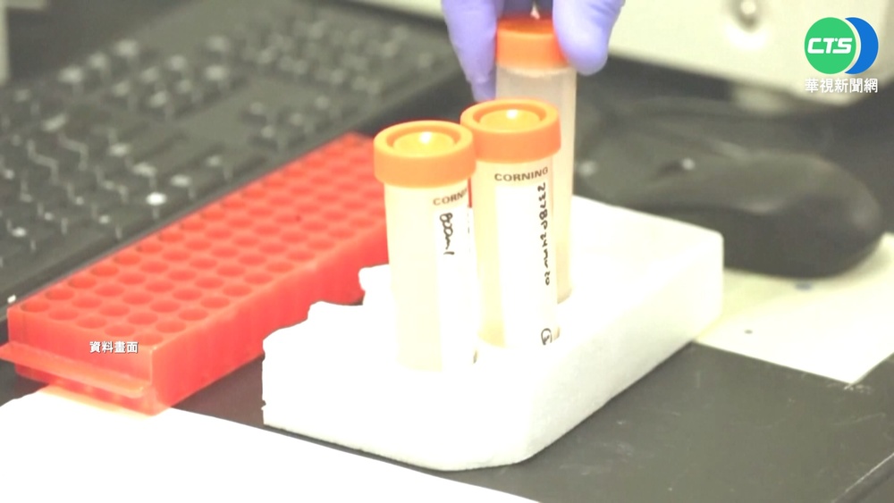 中央血清檢測漏"老小" 專家憂成效不彰