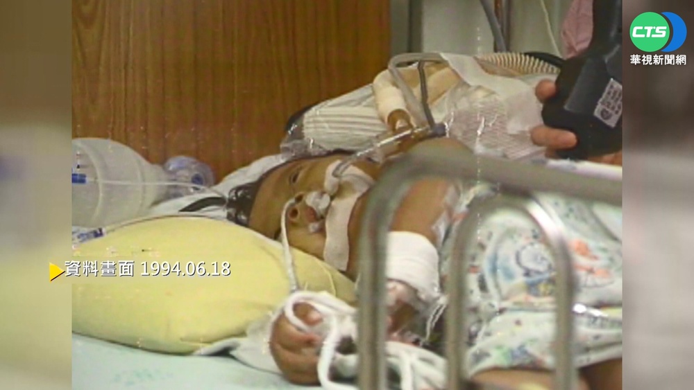 器官移植創生機 台首例活體肝臟移植