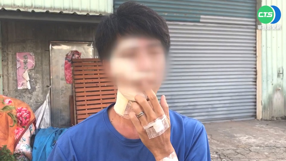 舊鹿港溪廊道危機四伏 路面鏤空害摔斷牙