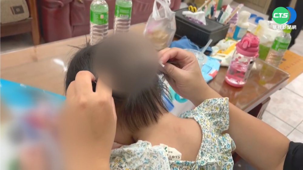 3歲女疑被推倒頭傷"開口笑" 母怒找真相