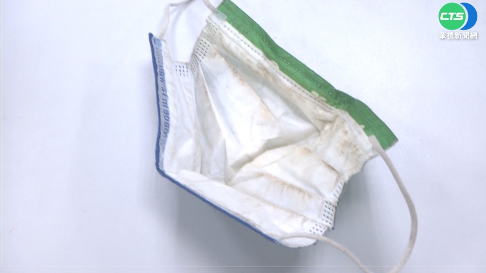 為省錢不換口罩! 男大生蜂窩性組織炎