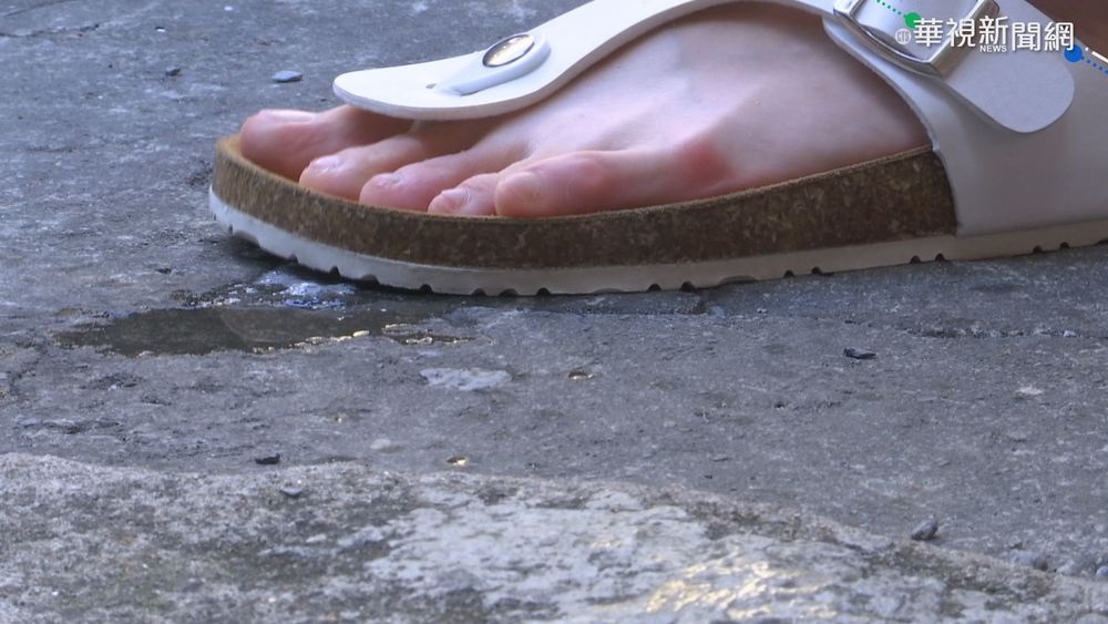 醫師談香港腳「嚴重恐蜂窩性組織炎」 日常保健一次看