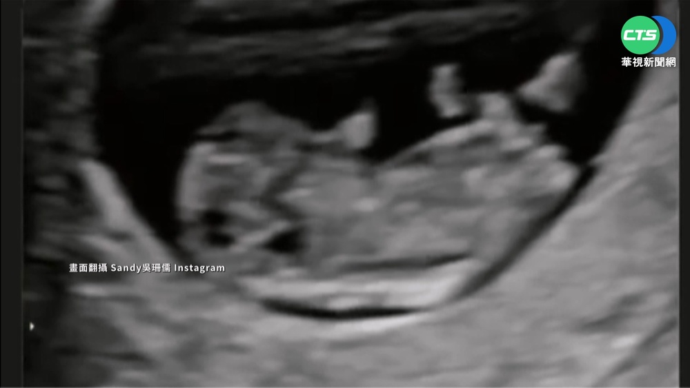 吳姍儒宣布當媽! 放閃老公.喜曬"超音波影片"