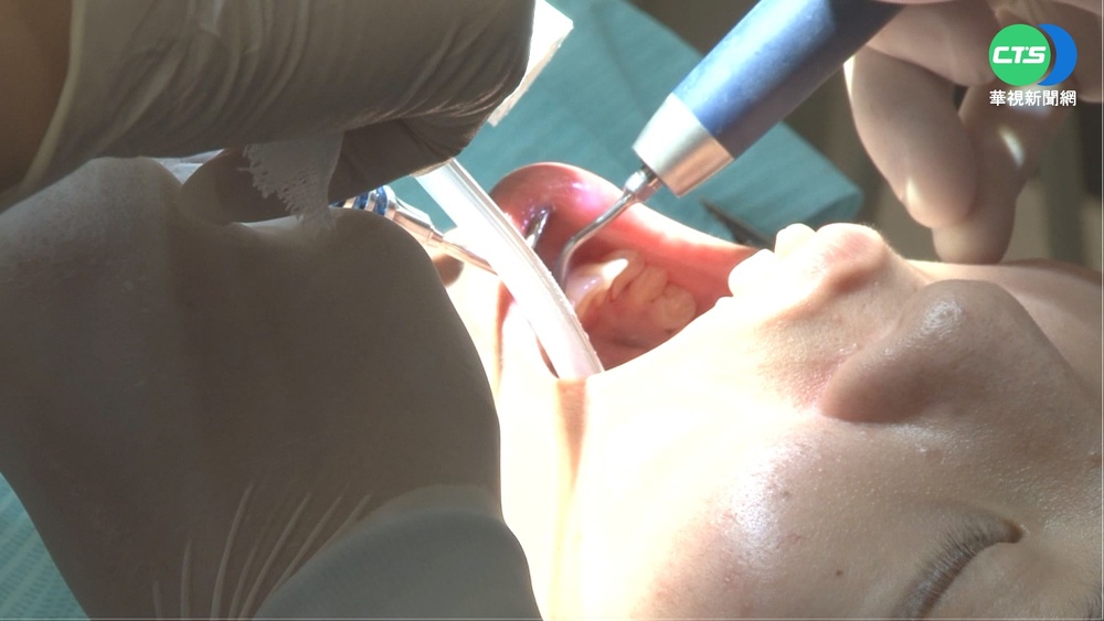 找工作遇性別歧視？男大生徵牙助遭拒「只徵女生」