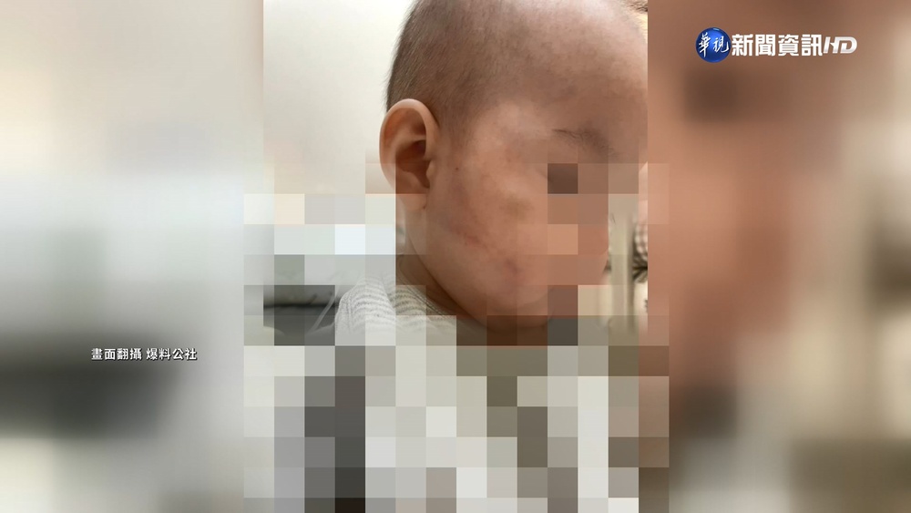 9月女嬰哭鬧遭保母掌摑 父母氣炸提告