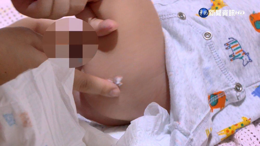 新生兒修護霜怎挑? 藥師:遵循使用年齡限制!