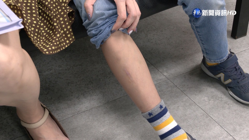 小五童遭公車門夾傷拖行 母控業者冷處理