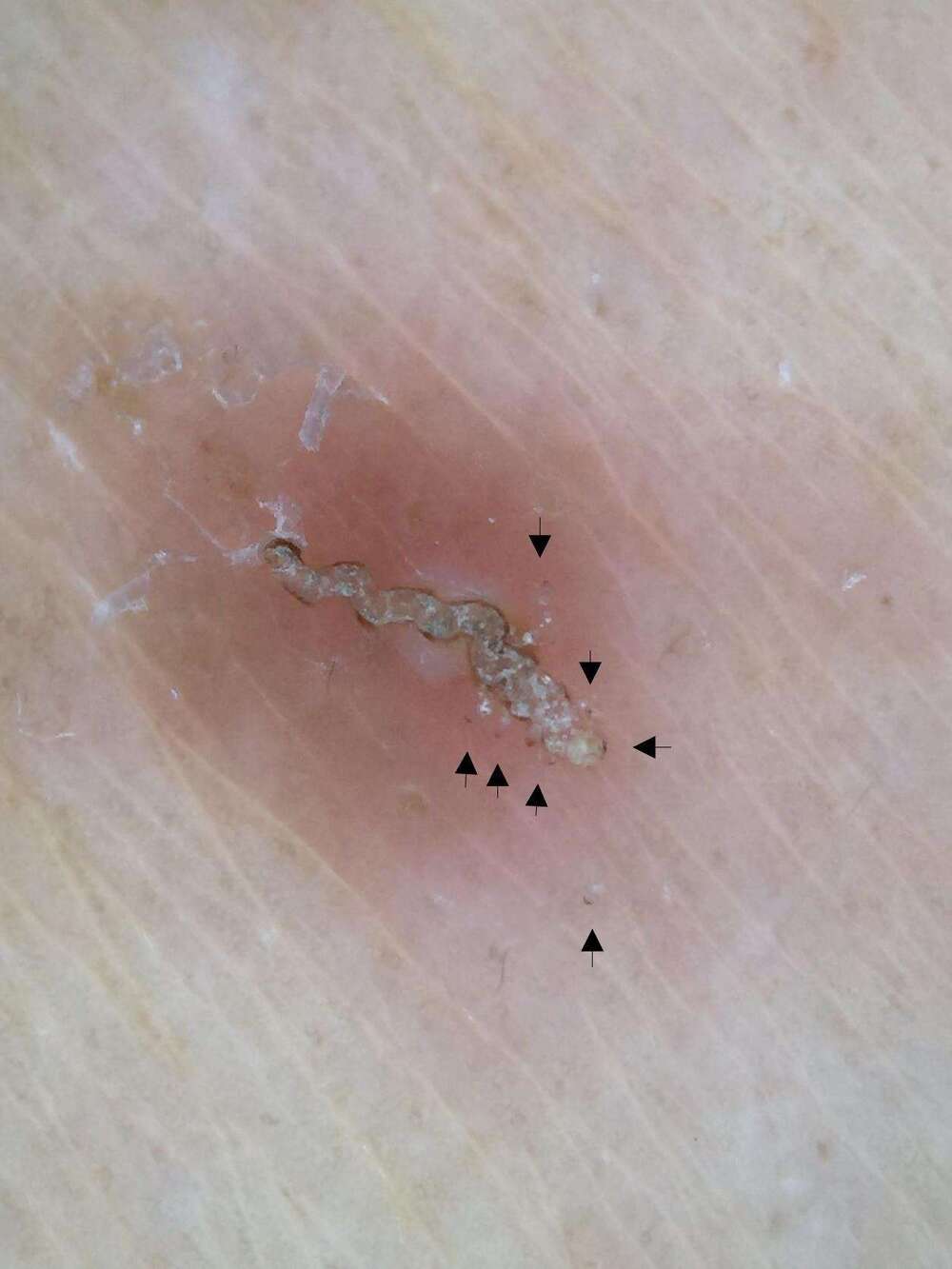 圖片來源 民生醫院