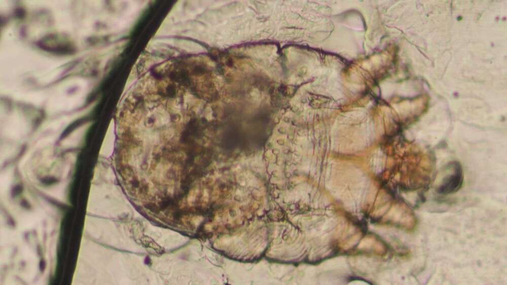 圖片來源 民生醫院