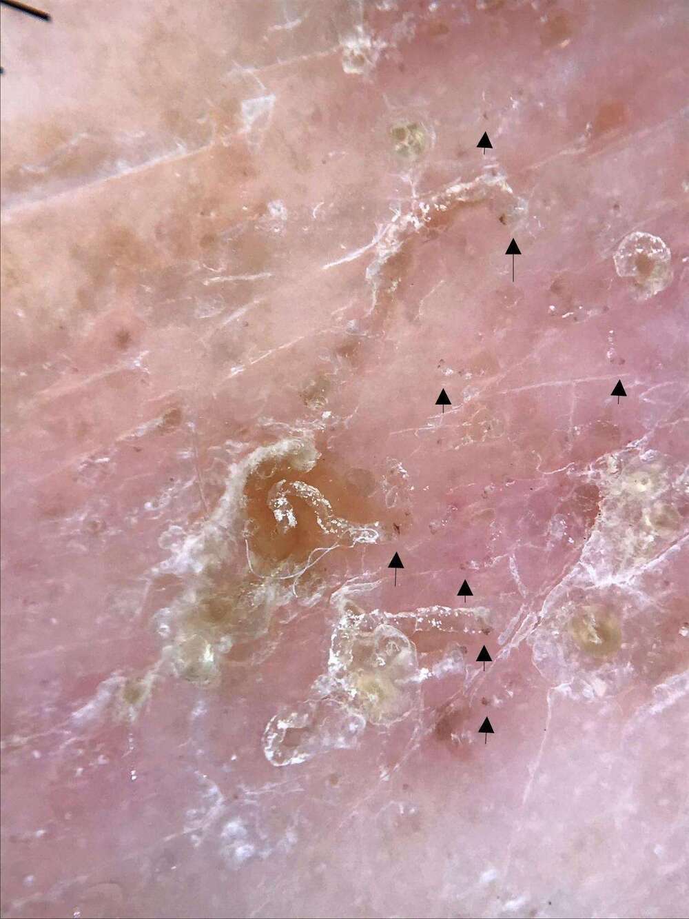 圖片來源 民生醫院