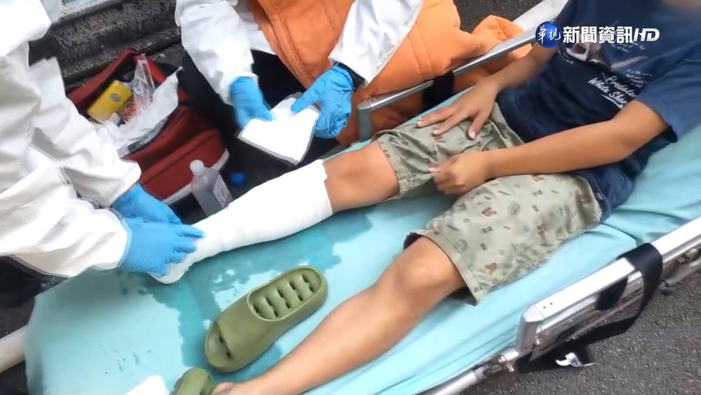 國小兄弟檔點蚊香釀火警 哥哥腿燒傷送醫