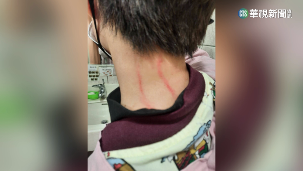 深夜探病遭拒　男嗆「又不是中國」毆護理師