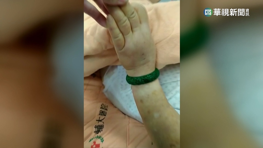 8旬婦百萬玉鐲卡手　新北消防脫戒達人救援