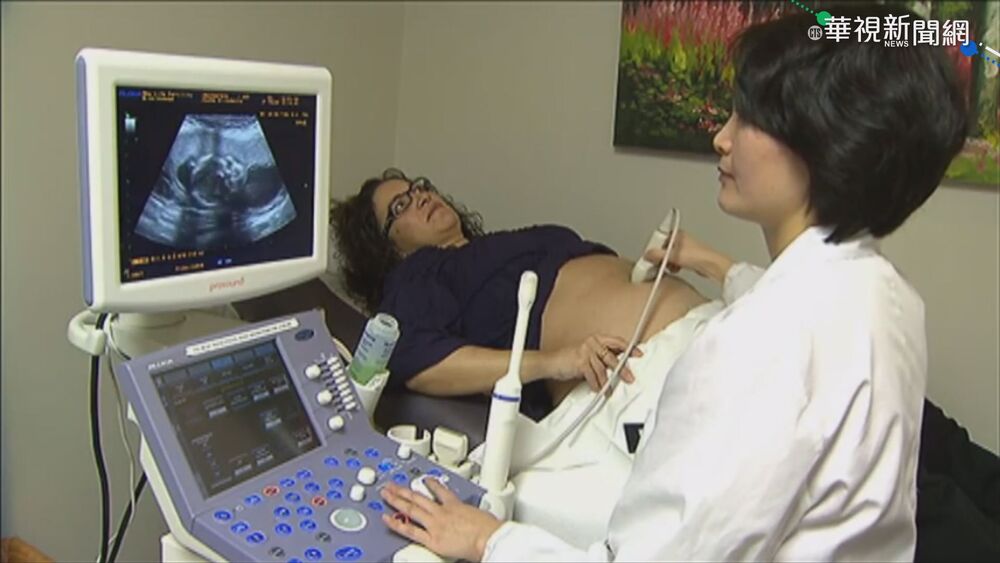 生育要趁早！女性超過35歲懷孕恐致胎兒染體異常
