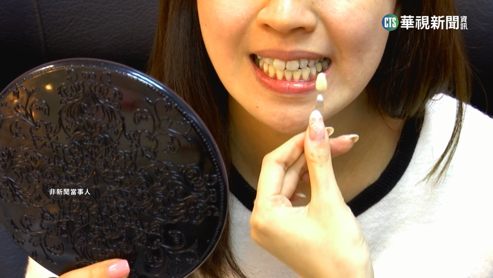 牙齒冷光美白反成「香腸嘴」　賠償談不攏槓診所