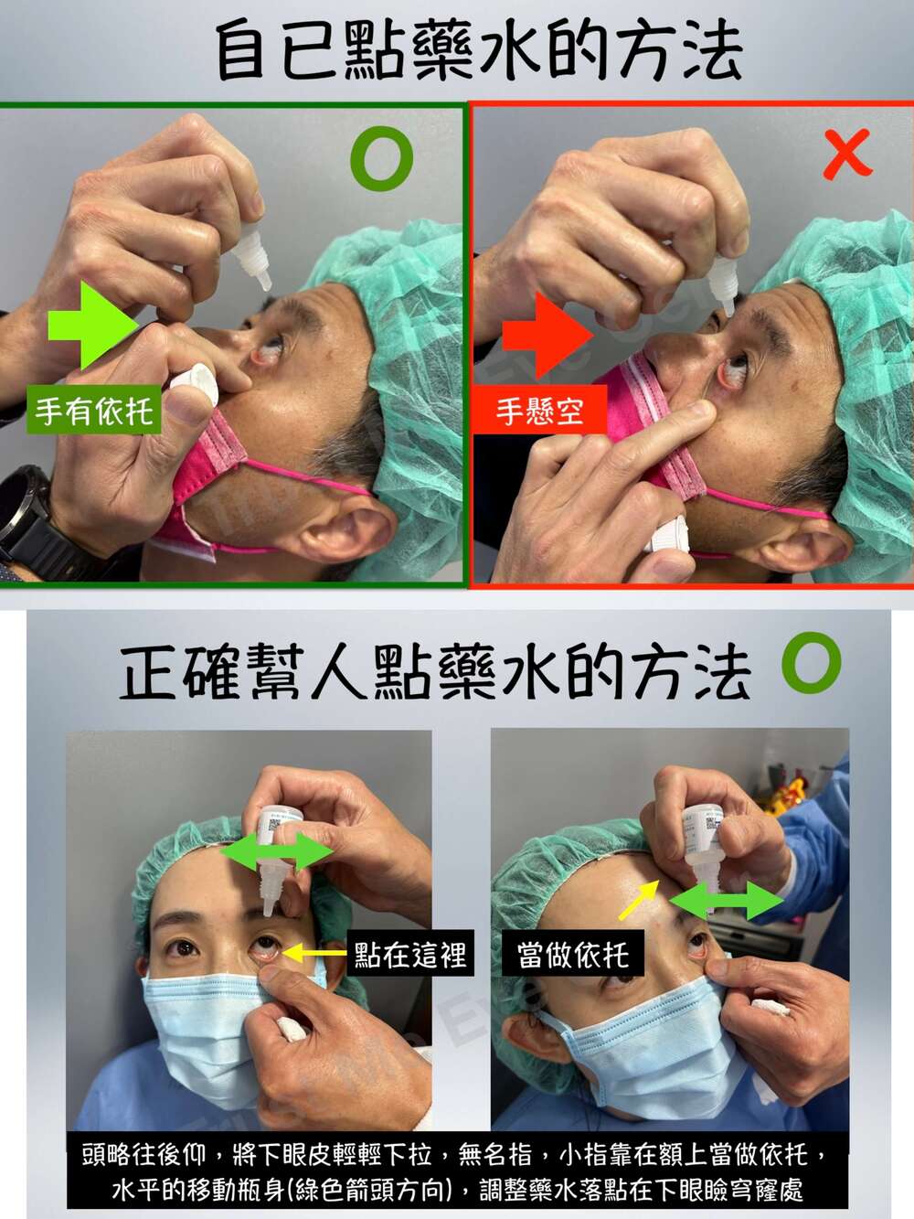 眼科醫師王孟祺教正確點藥水方式（圖/翻攝自臉書王孟祺醫師-眼科最前線）