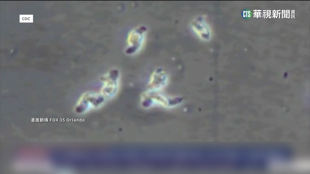 佛州男用自來水沖洗鼻腔　疑染「食腦蟲」喪命