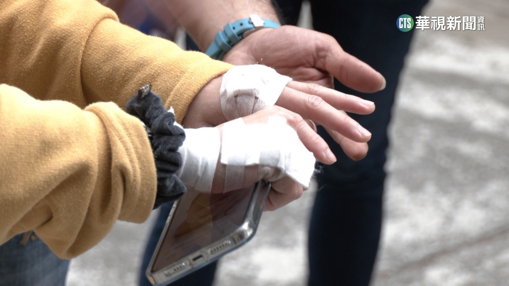 孔蓋螺絲鬆「凸出來」　騎士夫妻慘摔擬提國賠