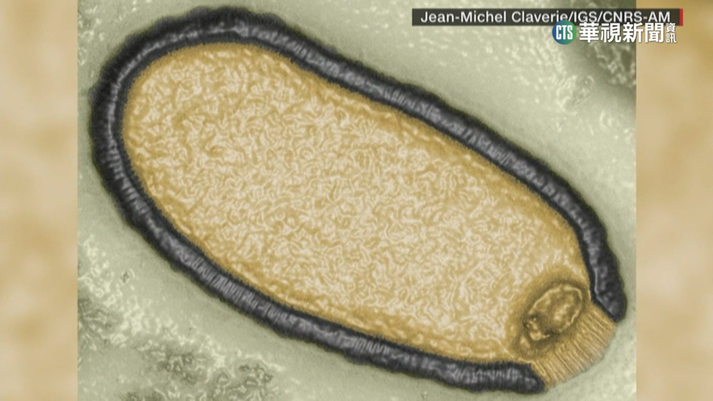 冰封永凍土「殭屍病毒」甦醒　醫示警恐釀大流行