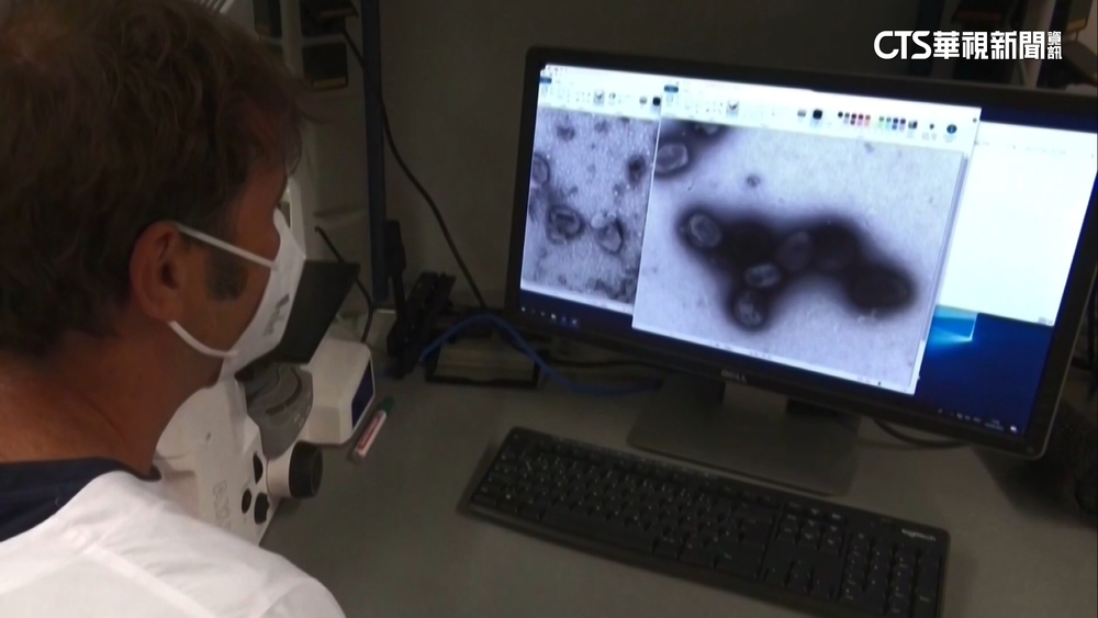 再爆5例猴痘個案　4例本土分布台北、新北、高雄