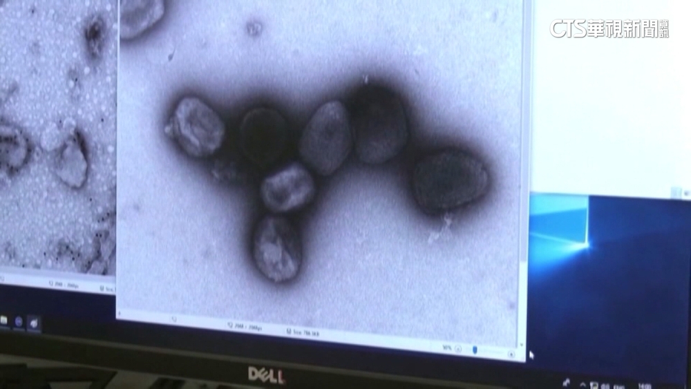 高雄第4例本土猴痘　男北部高風險場域接觸史