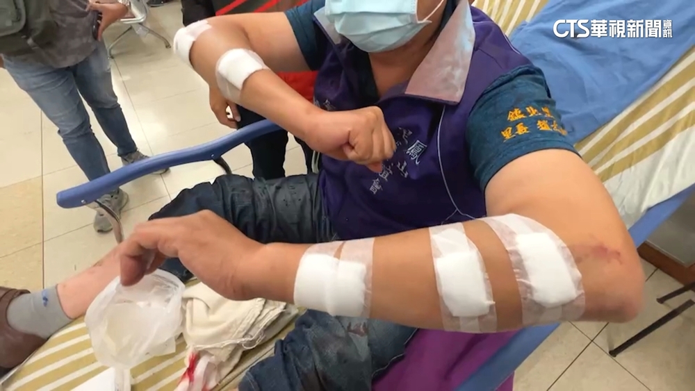 擋財路？　鳳山里長遭打　居民：疑與阻「儲能槽」有關