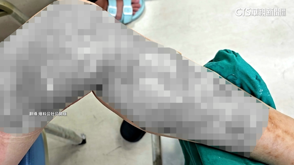 月子餐員工燙傷腿　控公司要求勿通報職災