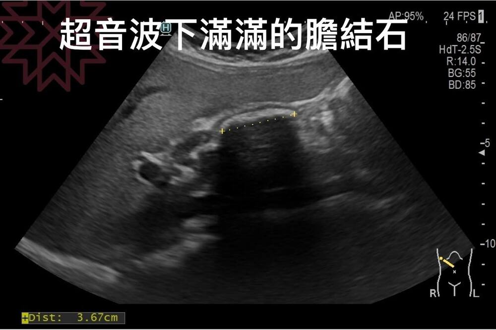 （圖/翻攝自臉書胰臟醫師 林相宏 禾馨民權內科診所）