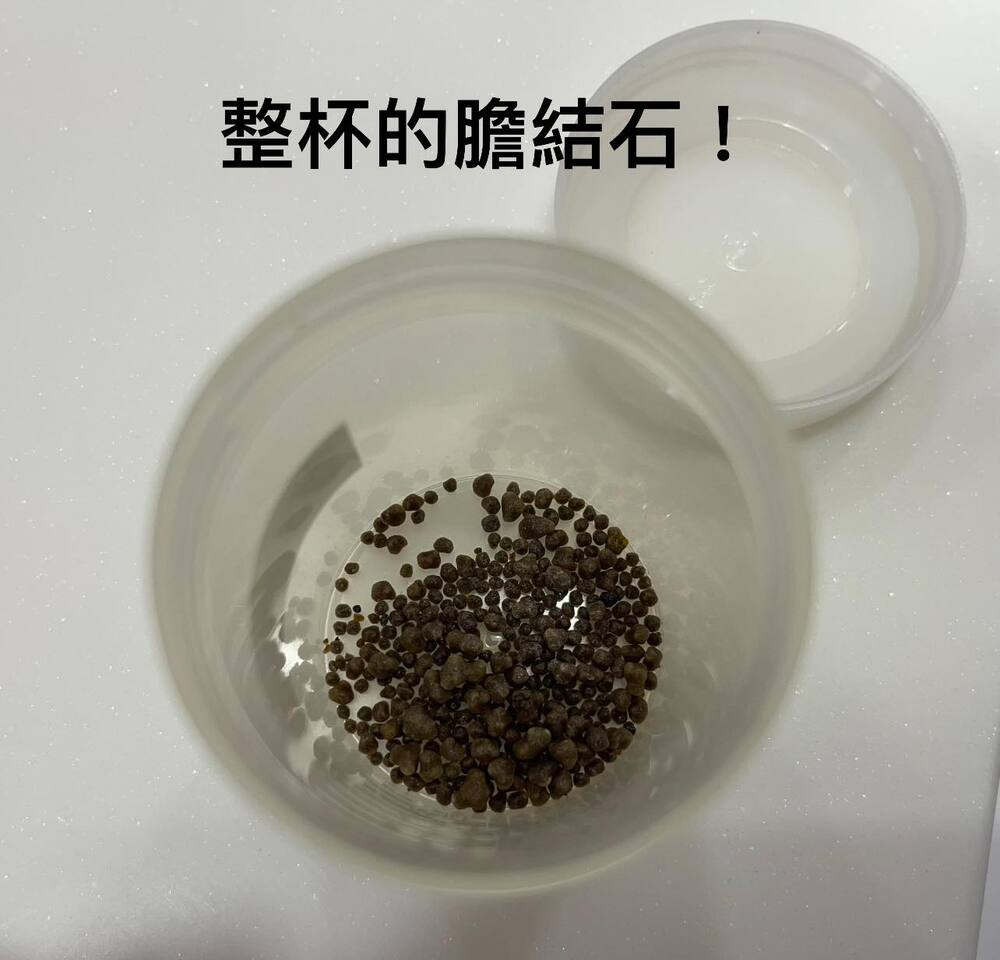 （圖/翻攝自臉書胰臟醫師 林相宏 禾馨民權內科診所）