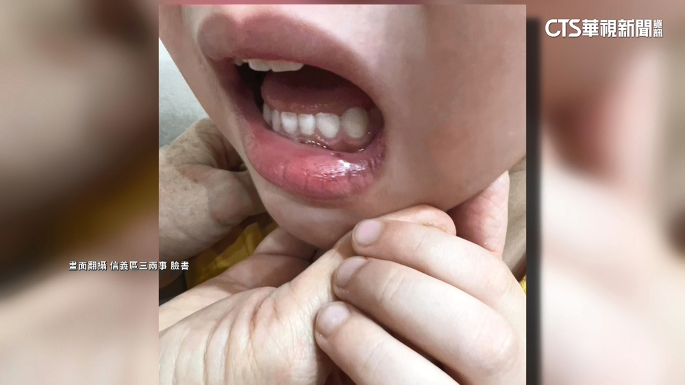 水箱蓋無預警掉落！　100cm小朋友撞傷嘴角