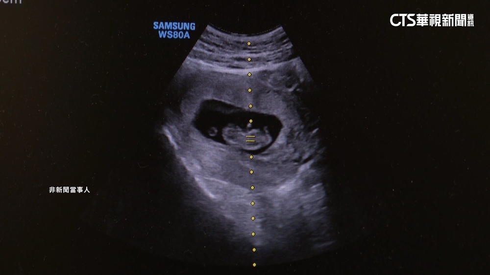 基因資訊恐外洩！　傳中「華大基因」低價滲台醫療院所