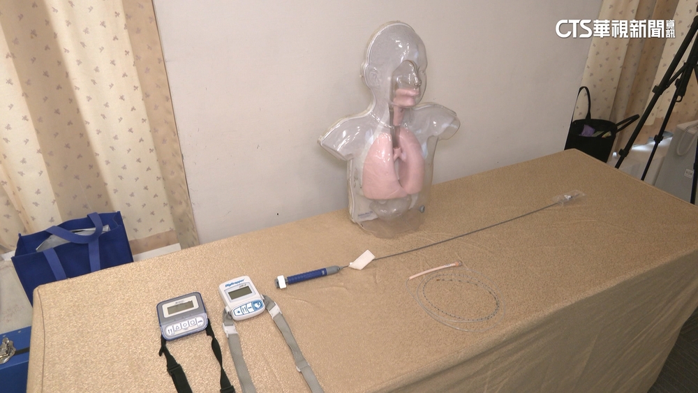 胃食道逆流太痛　40歲男吃藥沒用　「埋線」找病因