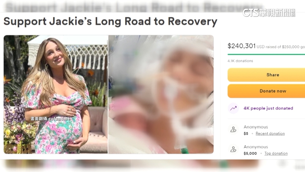 網紅「懷胎9月」突動脈瘤破　昏迷中剖腹產女