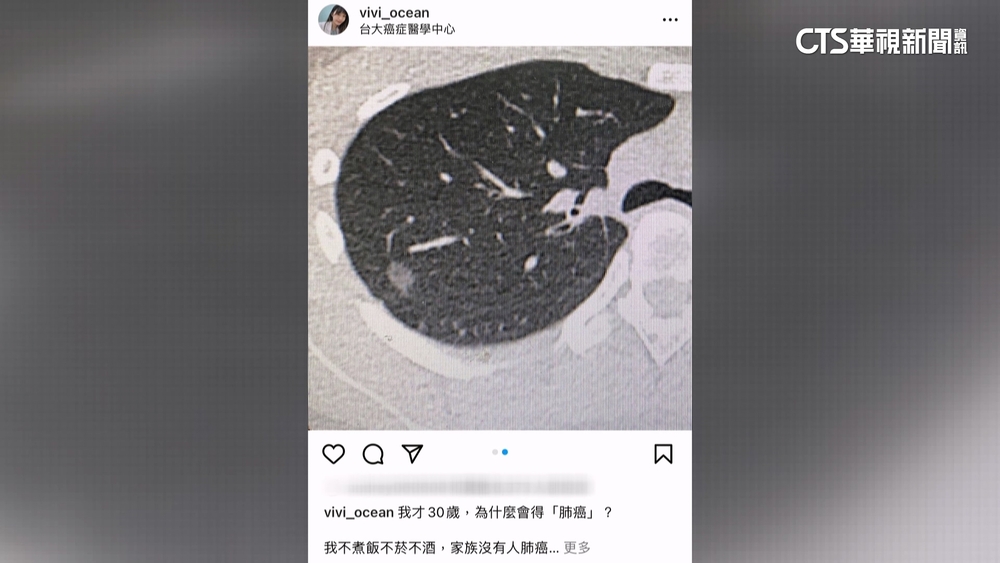 不菸不酒罹肺癌　「最美護理師」崩潰：我才30歲