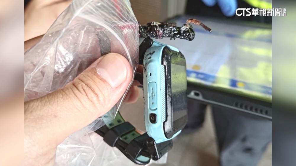 Herowatch智慧錶突爆炸！　童二度燒燙傷恐需植皮
