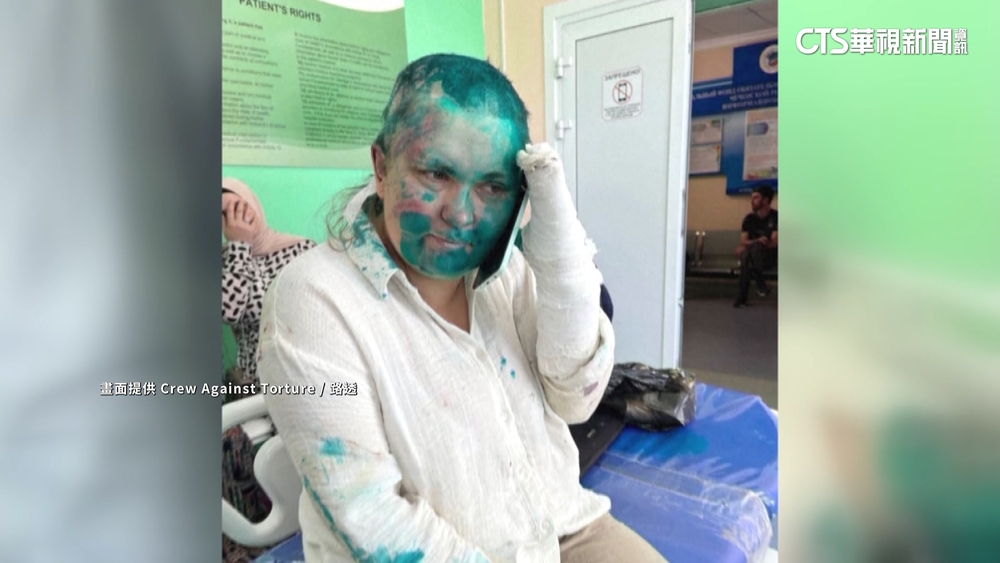 俄知名調查記者在車臣遭毆　克宮：需要調查