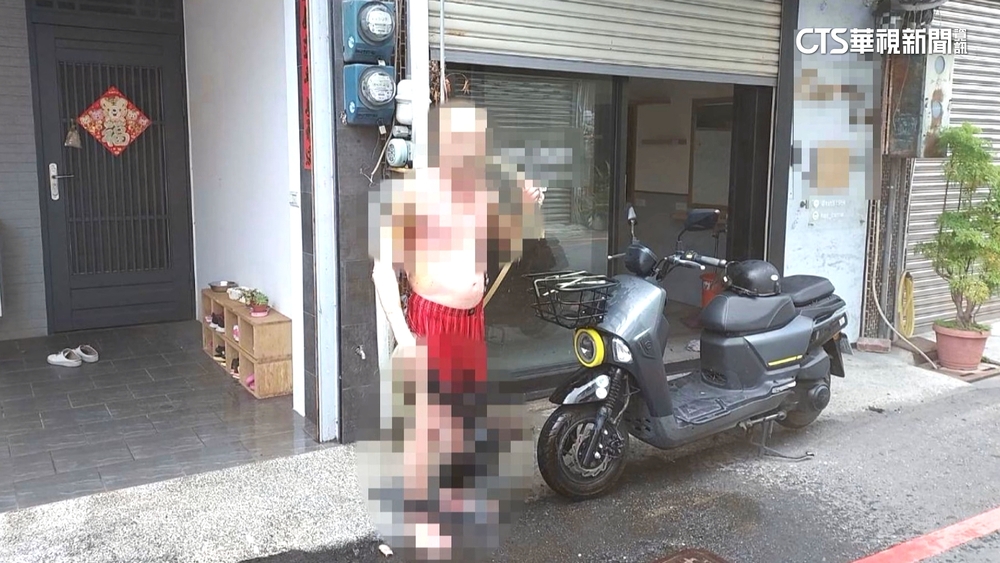 疑平板電腦充電爆炸　屋主90%燒燙傷插管搶救中