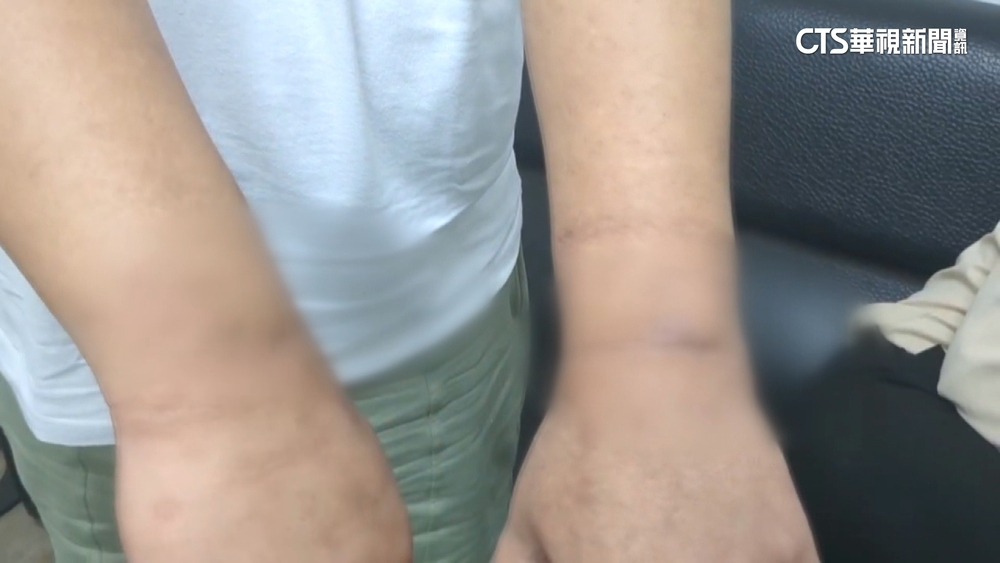 惡夢的1年！　男子被騙赴柬開餐廳遭凌虐轉賣