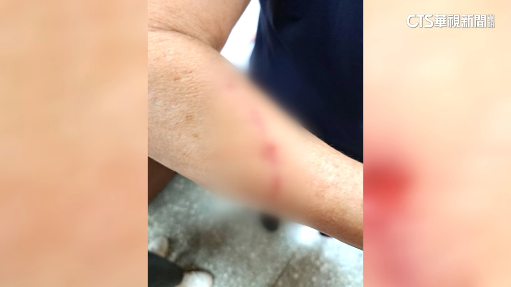 掩埋場回饋金喬不攏　大寮里民抗議爆推擠