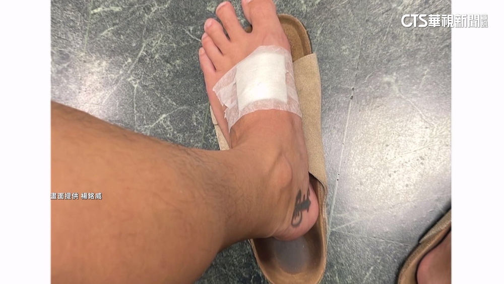 楊銘威遊永康公園被虎頭蜂螫！　喊話注意安全