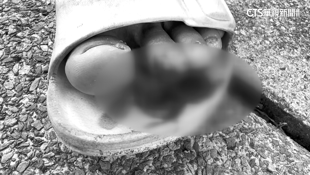 疑颱風威力強吹過來！　民眾沙灘誤踩鋼筋濺血