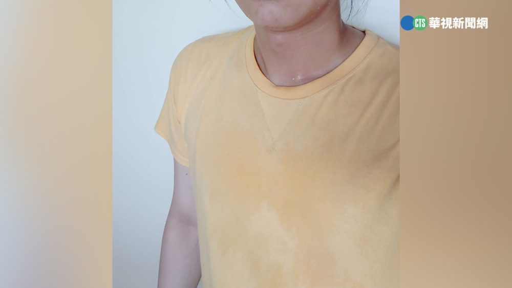 有無狐臭可從「耳垢」得知？　皮膚科醫師：「這種」耳垢易得狐臭